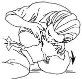 应急救护知识--心肺复苏术