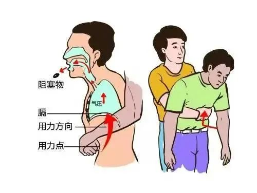 “救”在身边|应急救护知识科普