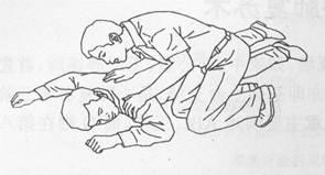 应急救护知识--心肺复苏术