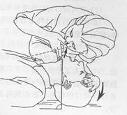 应急救护知识--心肺复苏术